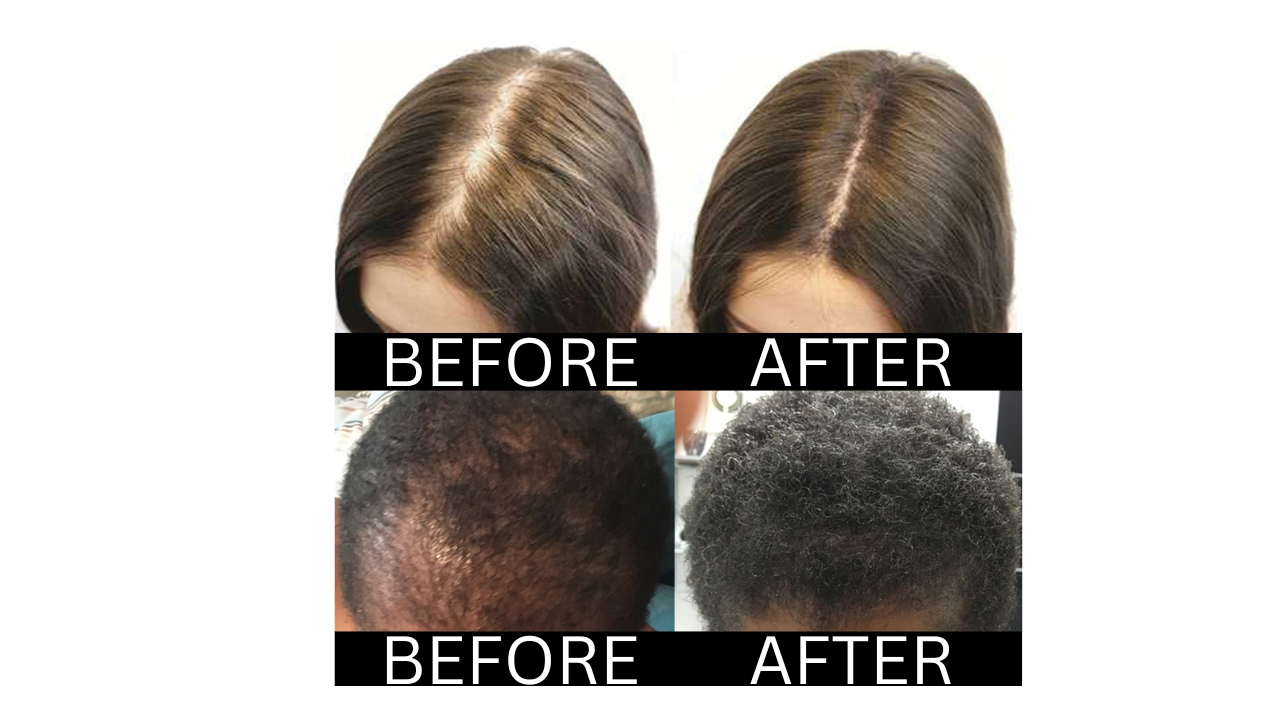 Aloe Vera For Hair Growth: Does it work? - Daytona Examiner